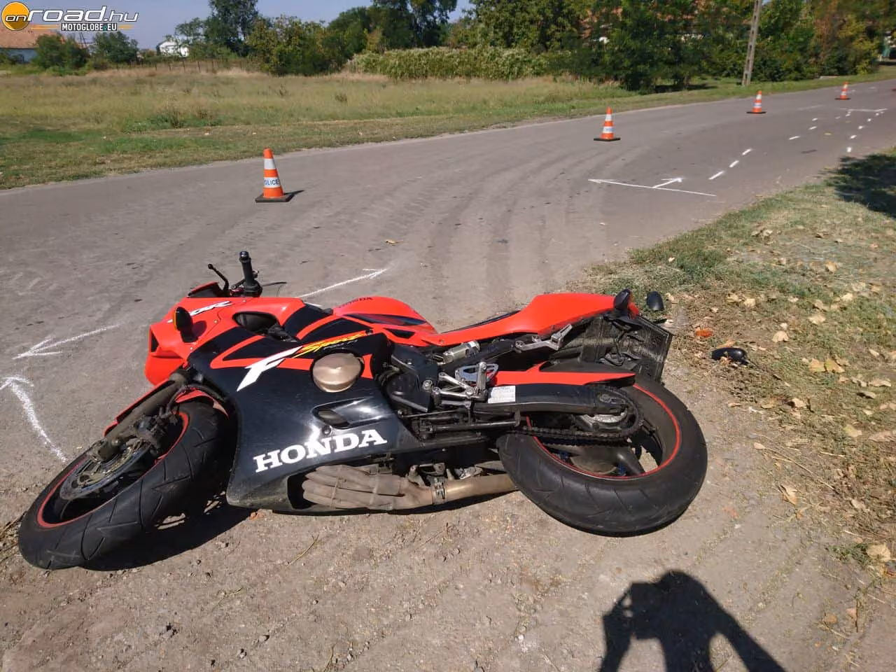 Egy motoros baleset egyes szám első személyben: ilyen, amikor veled történik meg Egy motoros baleset egyes szám első személyben: ilyen, amikor veled történik meg